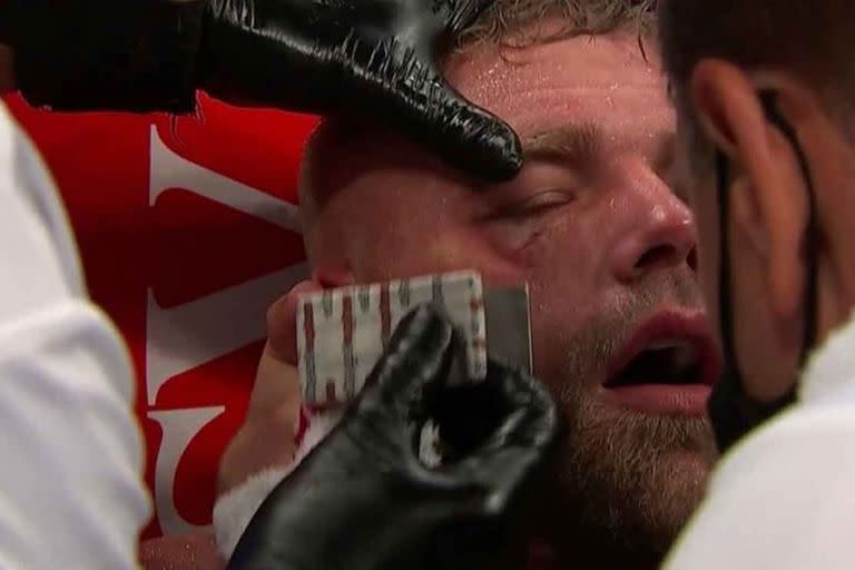 La grave lesión de Billy Joe Saunders, que tuvo que ser hospitalizado tras el golpe de Canelo Alvarez