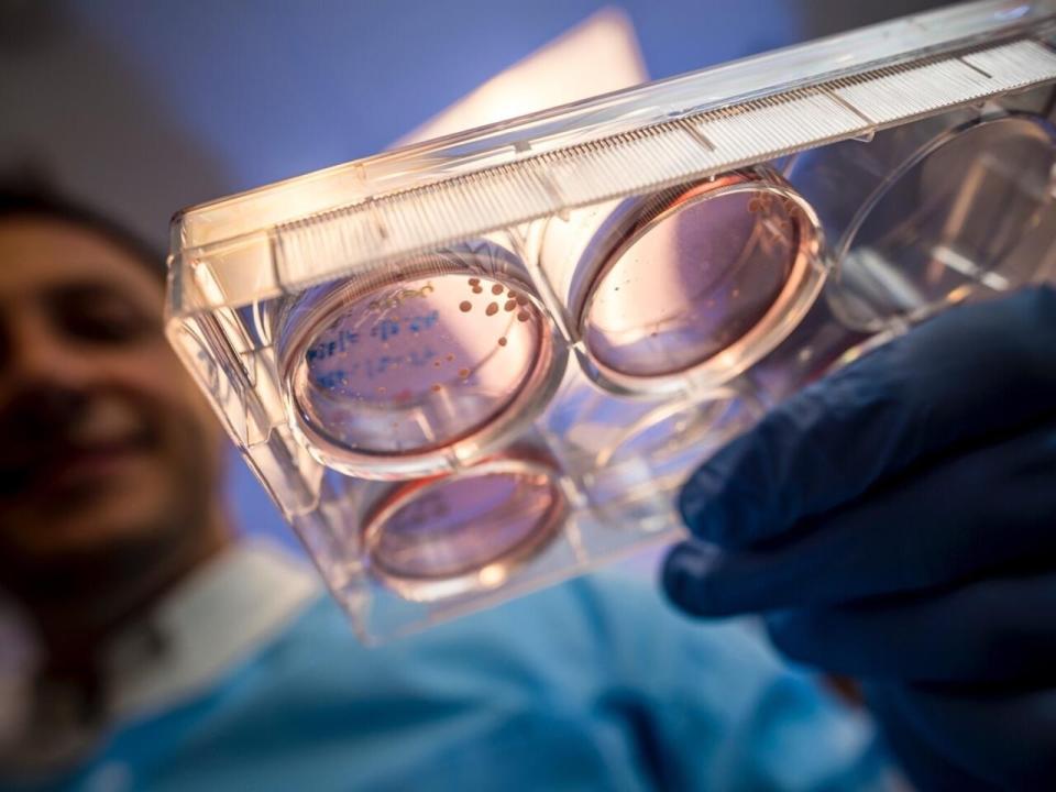 Organoides: órganos miniatura in vitro para comprender mejor las  enfermedades - Salud y bienestar