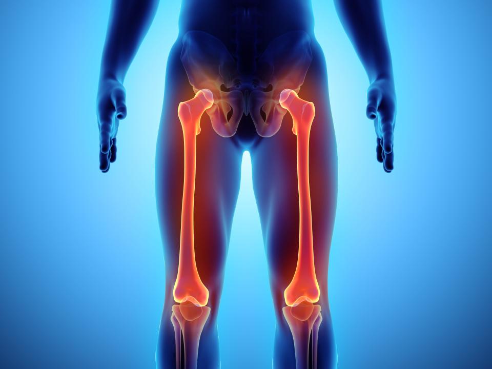 A 3D illustration of femur bones in the leg