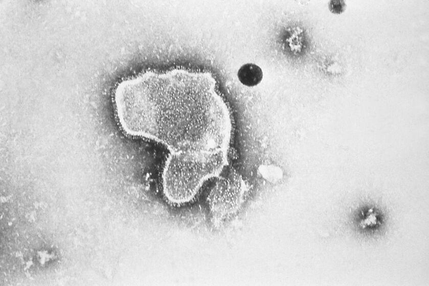 FILE - This 1981 photo provided by the Centers for Disease Control and Prevention (CDC) shows an electron micrograph of Respiratory Syncytial Virus, also known as RSV. New research announced by Pfizer on Tuesday, Nov. 1, 2022, showed vaccinating pregnant women helped protect their newborns from the common but scary respiratory virus that fills hospitals with wheezing babies each fall. (CDC via AP, File)