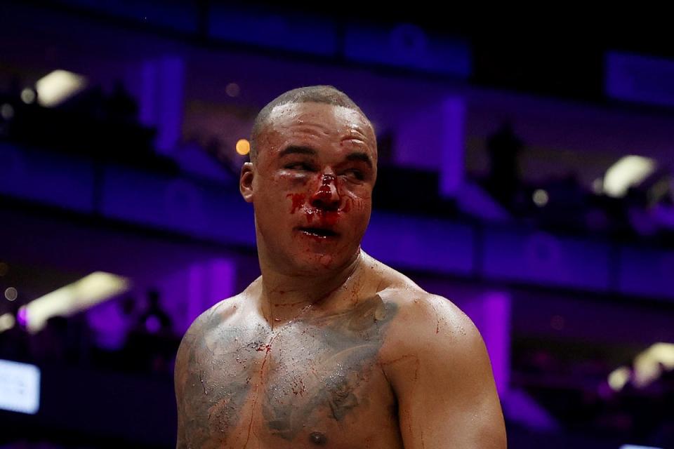 Wardley’s face was left a bloody mess, but he exited the O2 with his belts (Getty Images)