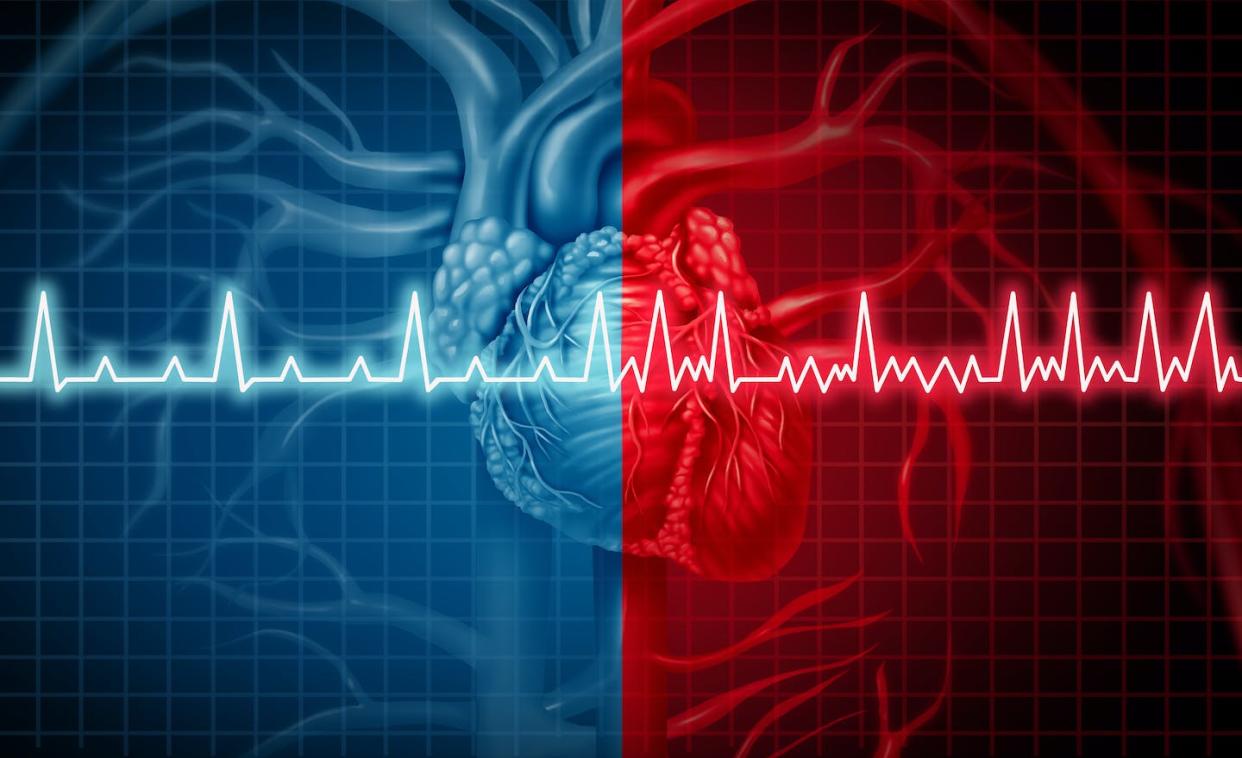 <a href="https://www.shutterstock.com/es/image-illustration/atrial-fibrillation-normal-abnormal-heart-rate-1064719589" rel="nofollow noopener" target="_blank" data-ylk="slk:Shutterstock / Lightspring;elm:context_link;itc:0;sec:content-canvas" class="link ">Shutterstock / Lightspring</a>