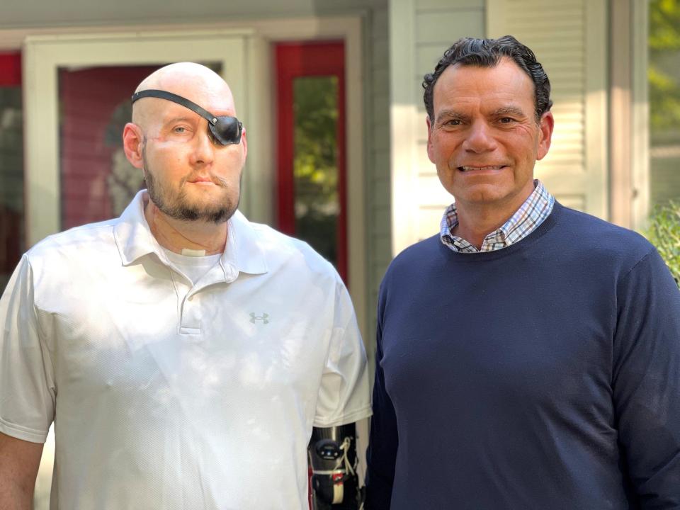 Aaron James, de Hot Springs, Arkansas, posa con el doctor Eduardo D. Rodríguez después de la cirugía por la que pasó, que incluyó el primer transplante completo de ojo del mundo