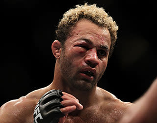 Josh Koscheck took a beating in his championship fight vs. GSP