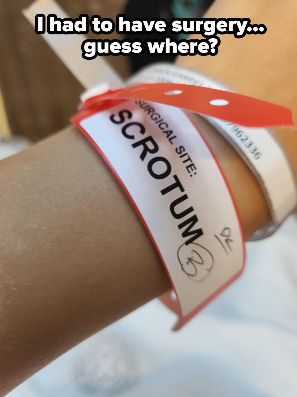 Close-up of an arm wearing a hospital wrist band that says "Surgical site: Scrotum," with caption: "I had to have surgery — guess where?"