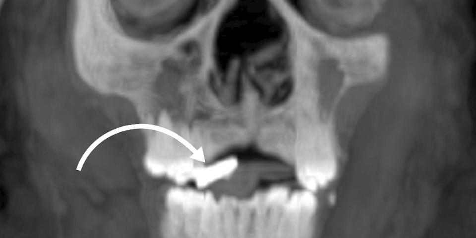 A scan of the boy's face shows the location of a golden tongue inside his mouth.