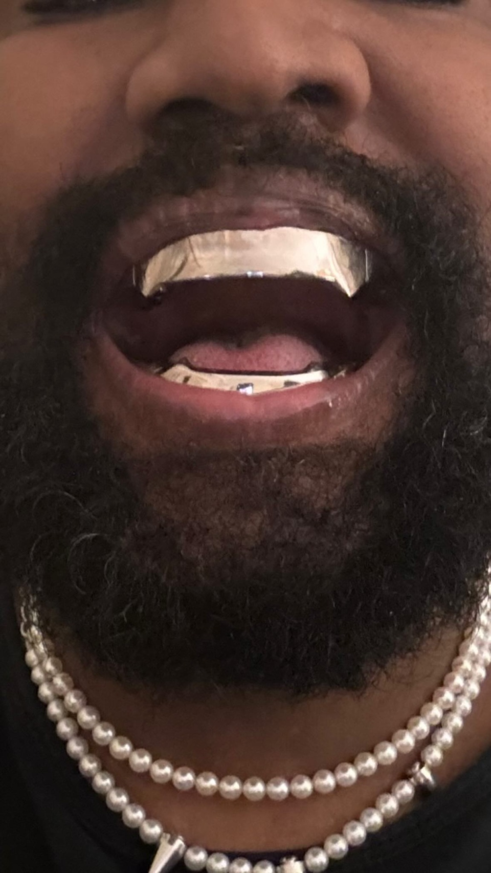Kanye West shows off new Jawsinspired teeth after getting '£670,000