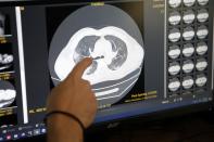 In this photo taken on Friday, May 8, 2020, a medical student checks the CT of a patient at the COVID-19 Clinic of Sotiria Hospital in Athens. Greece's main hospital for the treatment of COVID-19 is also the focus of a hands-on training program for dozens of medical students who volunteered to relieve hard-pressed doctors from their simpler duties while gaining a close peek at the front lines of a struggle unmatched in modern medical history. (AP Photo/Thanassis Stavrakis)