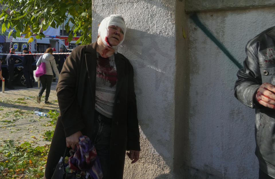 An injured woman reacts after Russian shelling, in Kyiv, Ukraine, Monday, Oct. 10, 2022. Two explosions rocked Kyiv early Monday following months of relative calm in the Ukrainian capital. (AP Photo/Efrem Lukatsky)