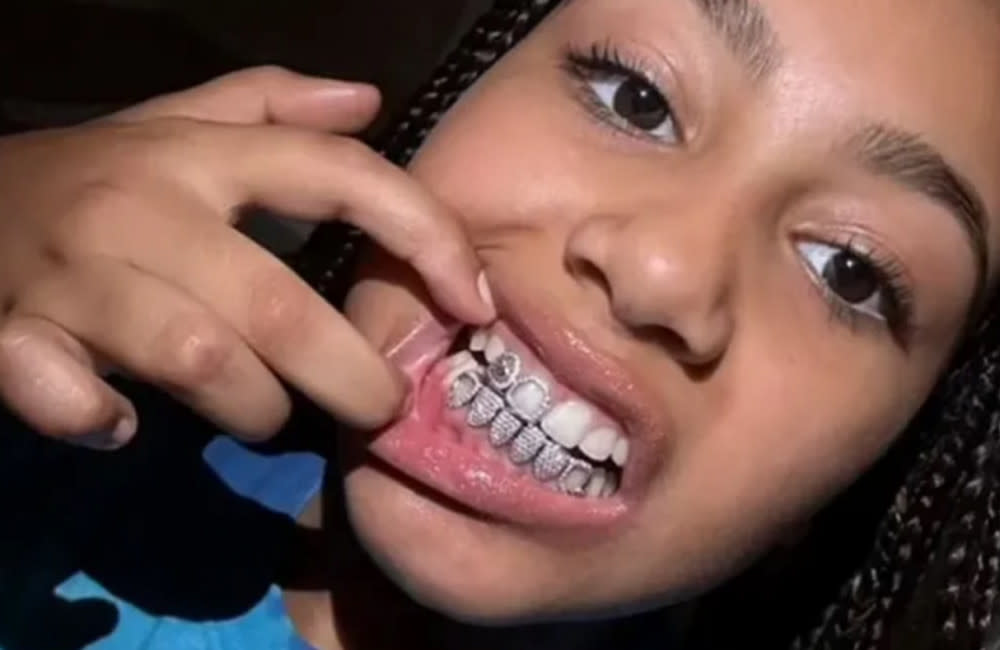 North West has flaunted a set of diamond teeth grills after her dad Kanye West showed off his metallic ‘dentures’ credit:Bang Showbiz