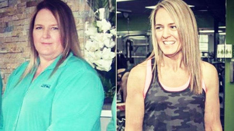 Australian Woman Loses 45 Kg With This Simple Exercise And Diet Plan -  News18