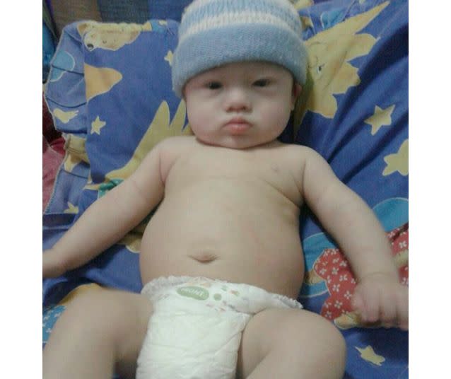 Six-month-old Gammy has been left behind by his Australian parents. Photo: Hope for Gammy.