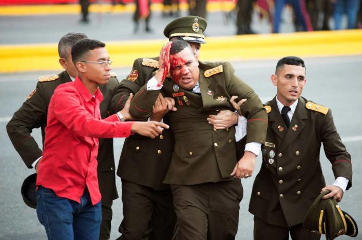 Un funcionario venezolano es auxiliado tras recibir una herida en la cabeza, luego que uno de los drones cargados con explosivos estallara durante el atentado ocurrido el 4 de agosto.