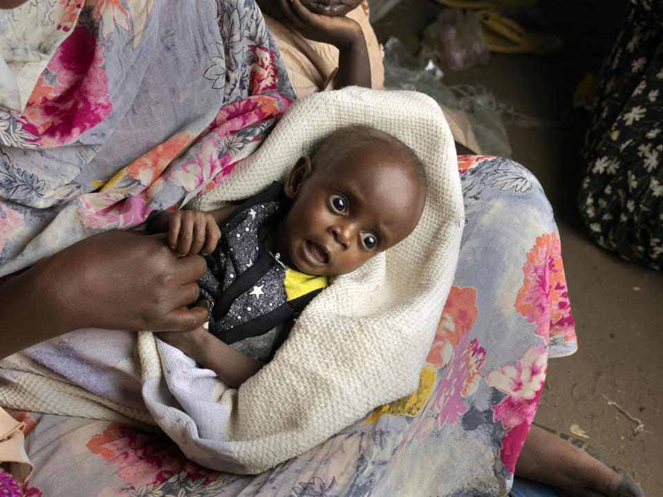 A malnourished child in the arms of his mother in South Sudan.