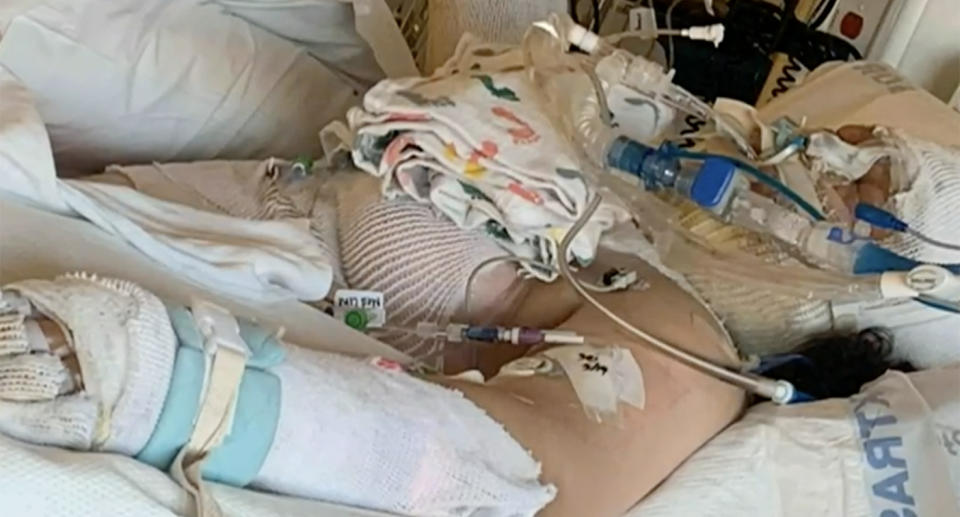 Destini Crane was left with severe burns after attempting a TikTok challenge and accidentally setting herself on fire.