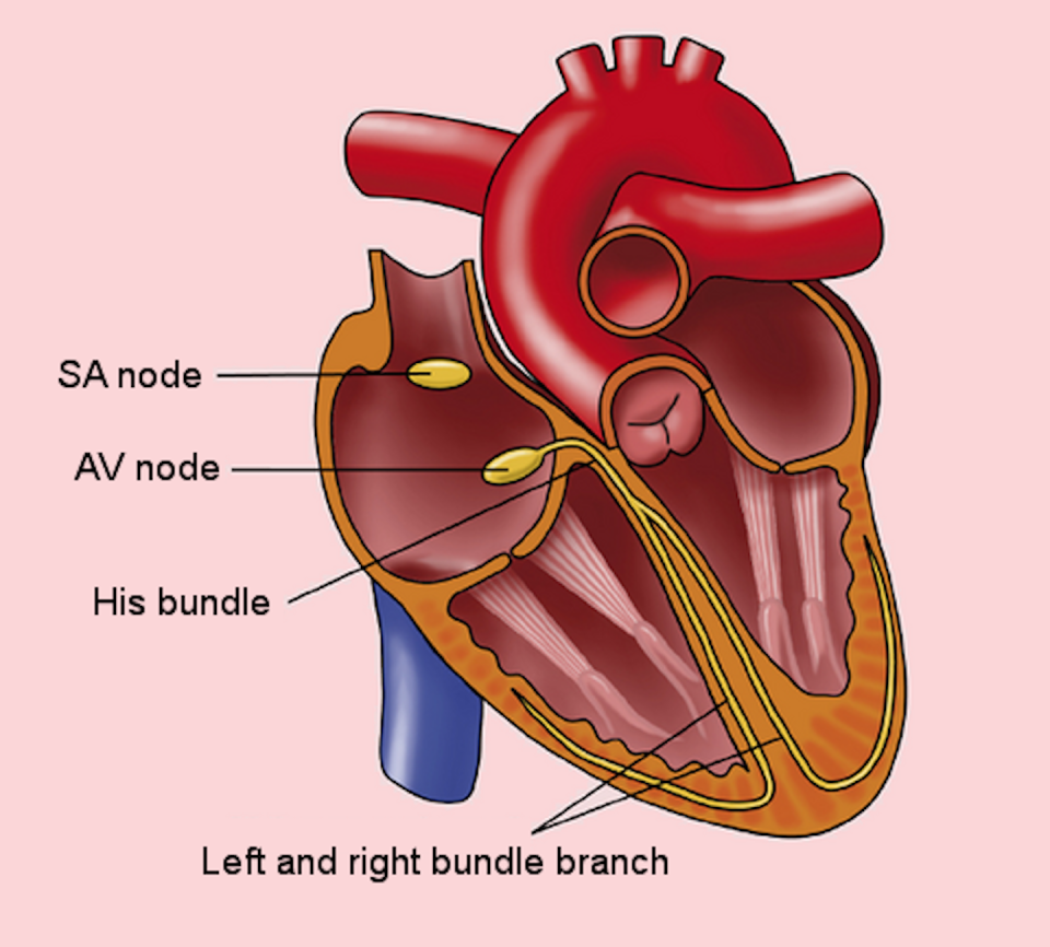 Breakdowns in the sinoatrial and atrioventricular nodes can cause heart rate problems. <a href="https://commons.wikimedia.org/wiki/File:Conduction_system_en_(CardioNetworks_ECGpedia).png" rel="nofollow noopener" target="_blank" data-ylk="slk:Rob Kreuger, medical illustrator/Wikimedia Commons;elm:context_link;itc:0;sec:content-canvas" class="link ">Rob Kreuger, medical illustrator/Wikimedia Commons</a>, <a href="http://creativecommons.org/licenses/by-sa/4.0/" rel="nofollow noopener" target="_blank" data-ylk="slk:CC BY-SA;elm:context_link;itc:0;sec:content-canvas" class="link ">CC BY-SA</a>