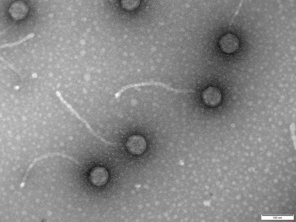 Phages, viruses ‘eat’ bacteria to fight antibiotic resistance