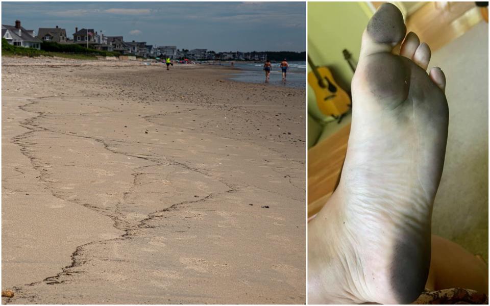 People who visited multiple beaches in southern Maine on Monday, June 7, 2021, reported an unusually dark staining on the soles of their feet. The photo on the right was taken by April Schneider after she visited a beach in York. The photo on the left was taken as beachgoers enjoyed the sand and sun in Wells on Tuesday, June 8, as state officials continued to investigate what may be causing the issue.