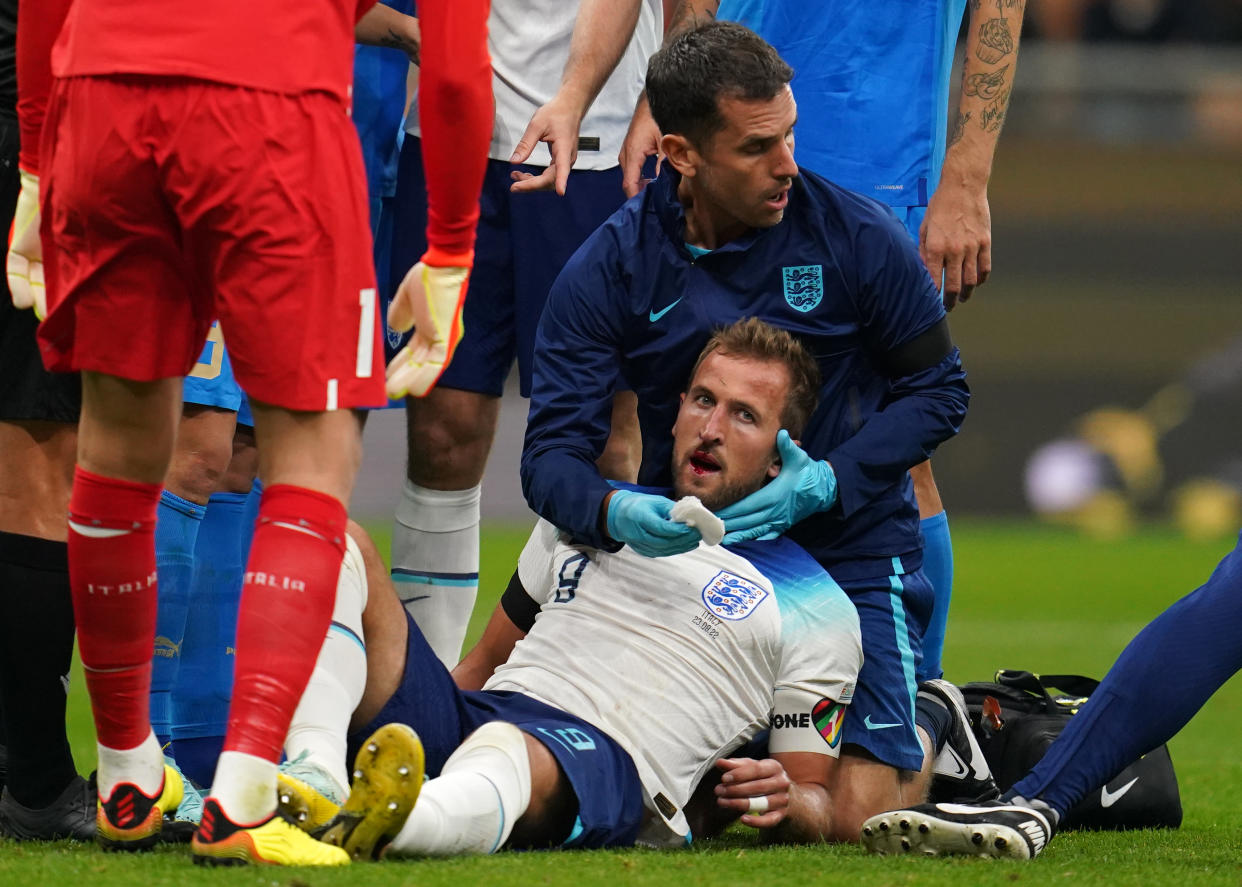 England's Harry Kane receives treatment after a clash of heads during the UEFA Nations League match at San Siro Stadium in Milan, Italy. Picture date: Friday September 23, 2022. (Photo by Nick Potts/PA Images via Getty Images)