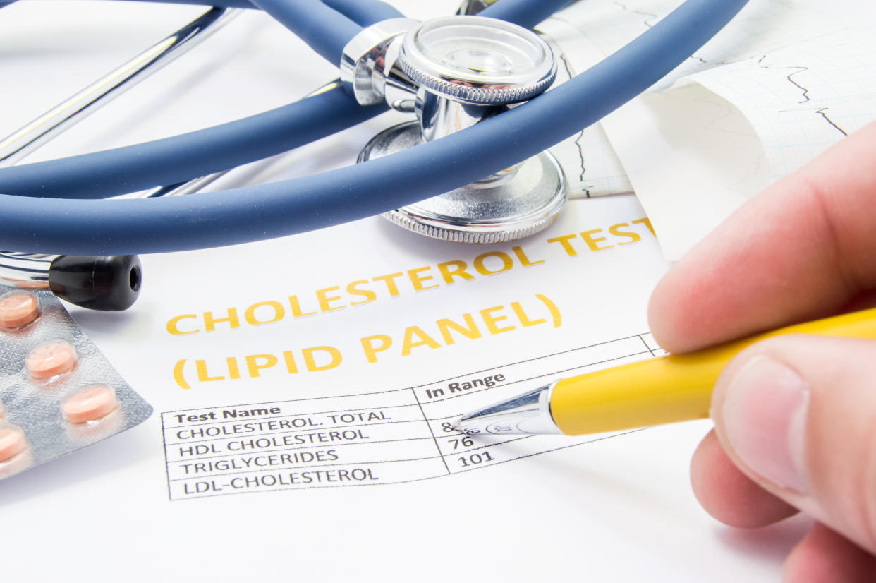 El médico general comprueba los niveles de colesterol en los resultados de las pruebas de los pacientes sobre los lípidos en sangre. (Foto: Getty Images)