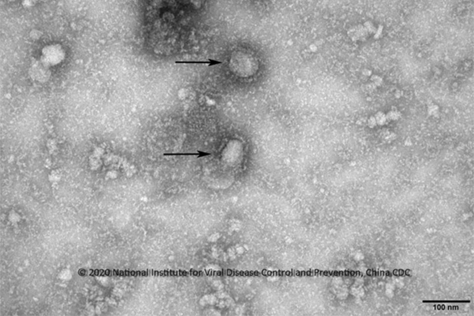 中國大陸公開武漢肺炎新型冠狀病毒的影像。   圖源：中國疾病預防控制中心國家病毒性疾病預防控制所