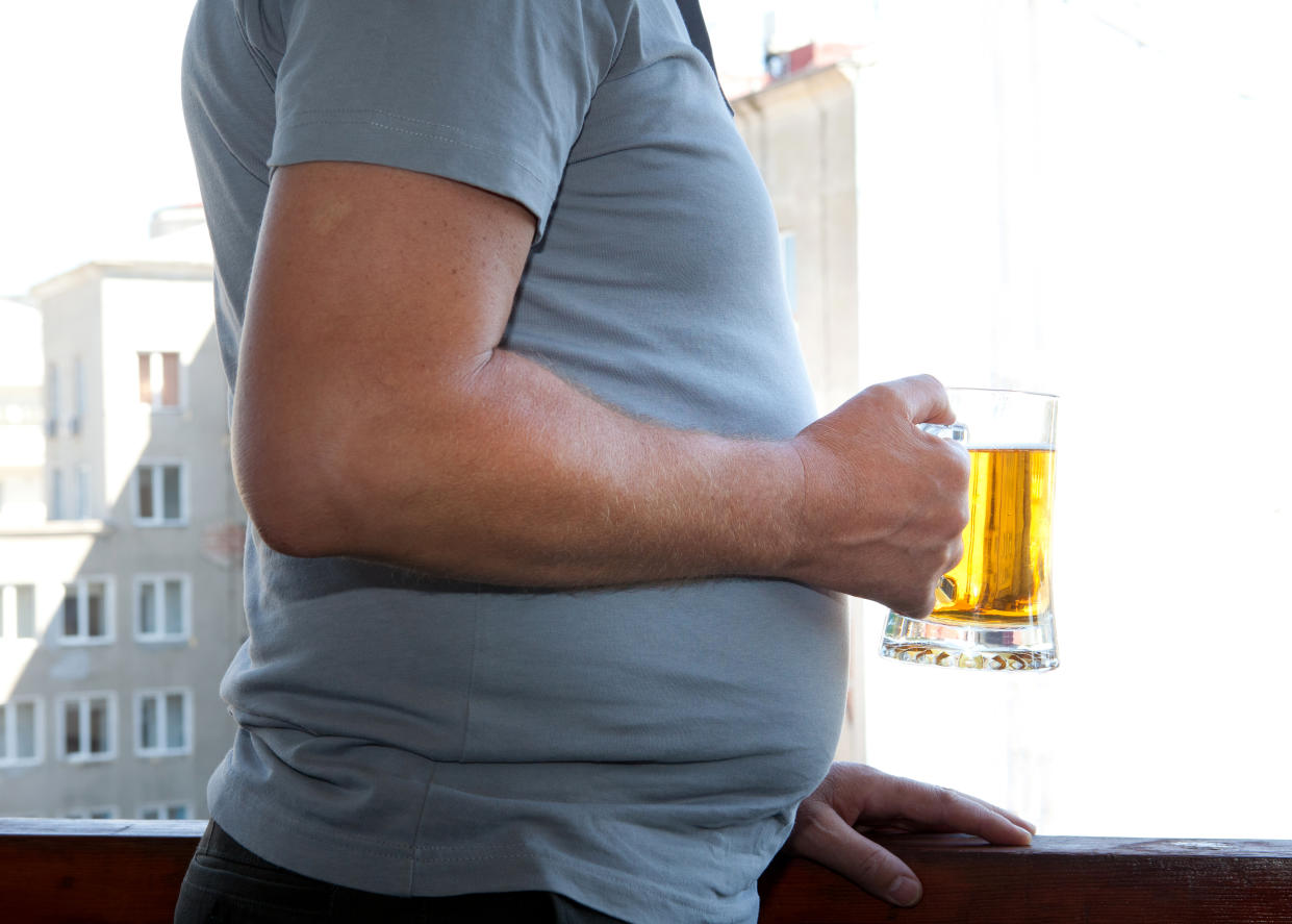 Man holding beer with beer belly. demetia