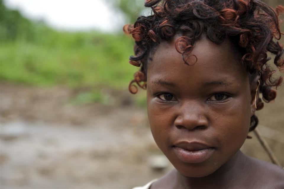 Katushabe Choice, 20 years old, lives with her three children age 6, 3 and 1 respectively, in Western Uganda. She got married when she was only 13 years old. She delivered her first child when she was 13 years old.&nbsp;