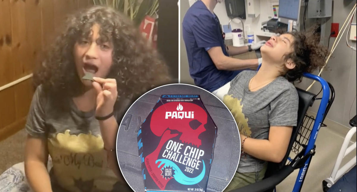 Tiktok Chip Challenge Leaving People Hospitalised I Couldnt Breathe