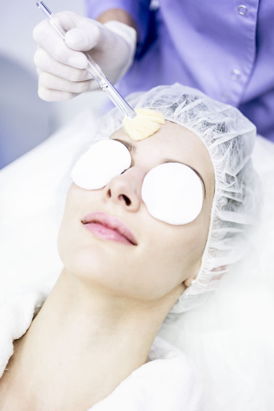 Fraxel Laser Resurfacing Treatment