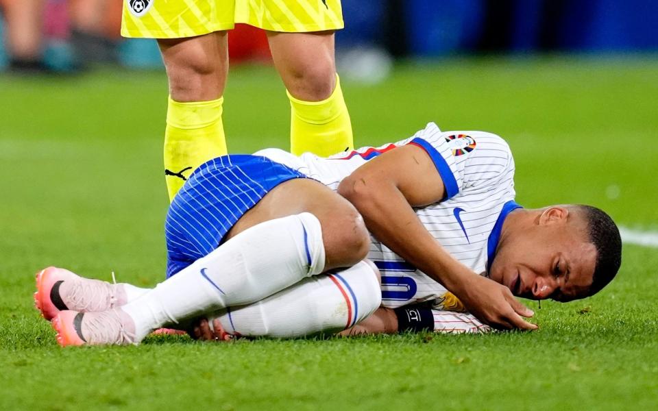 Kylian Mbappe's Euros in doubt after breaking his nose during narrow France win