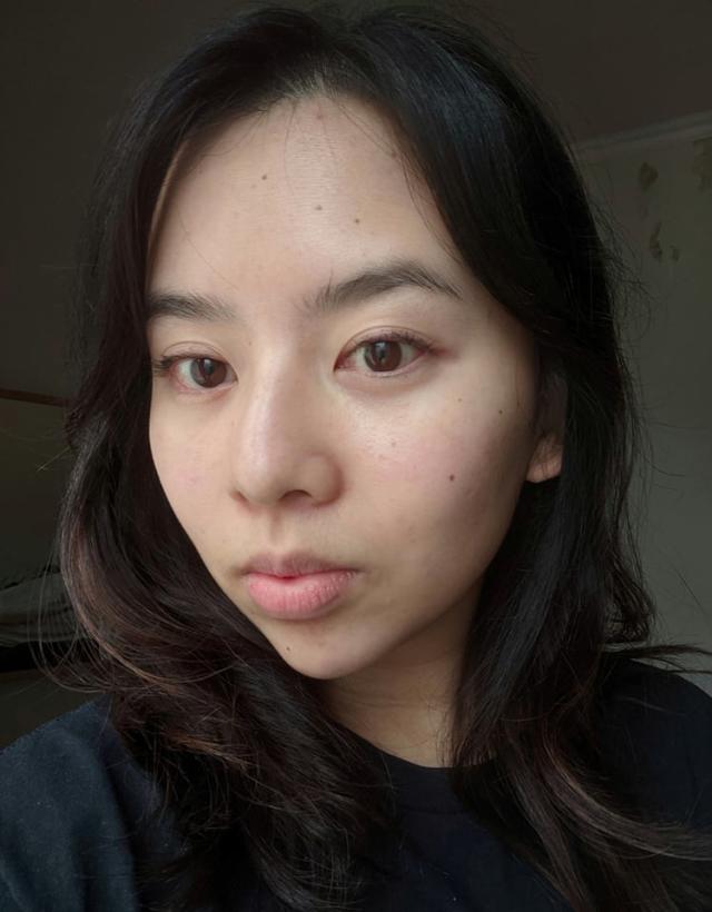 MEDICUBE Zero Pore Line after 2 months - So did it work for me
