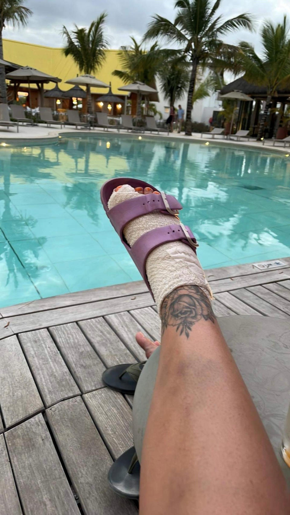 Amy Thomson spent the rest of her honeymoon unable to walk properly with a bandaged foot. (SWNS)