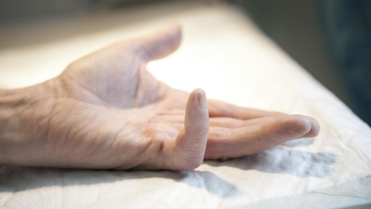  Hand lying palm up on white foreground with pinky bent upward 