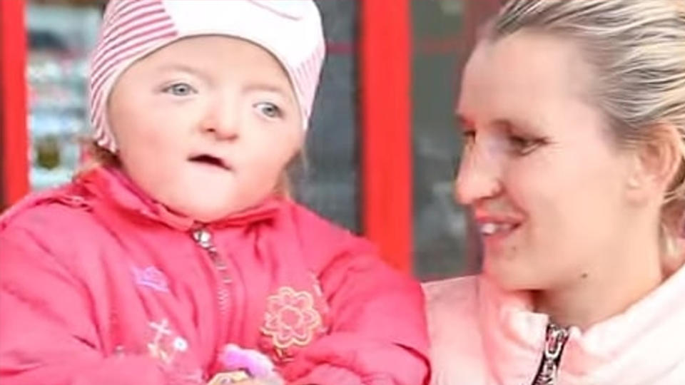 Sofya with her mother, who says a school will not accept Sofya because her deformity may scare the other school children.