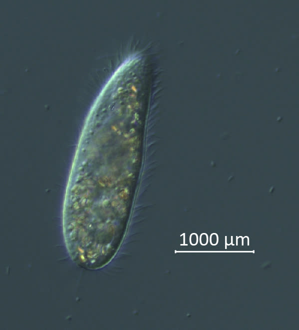 This photo provided by researchers shows a Philaster apodigitiformis ciliate microorganism viewed under the microscope at the University of South Florida College of Marine Science in St. Petersburg, Fla. The measurement scale of 1000 micrometers is equal to 1 millimeter. The tiny single-celled organism is to blame for a massive die-off of sea urchins in the Caribbean in 2022, researchers reported Wednesday, April 19, 2023, in the journalScience Advances. (Mya Breitbart/University of South Florida College of Marine Science via AP)