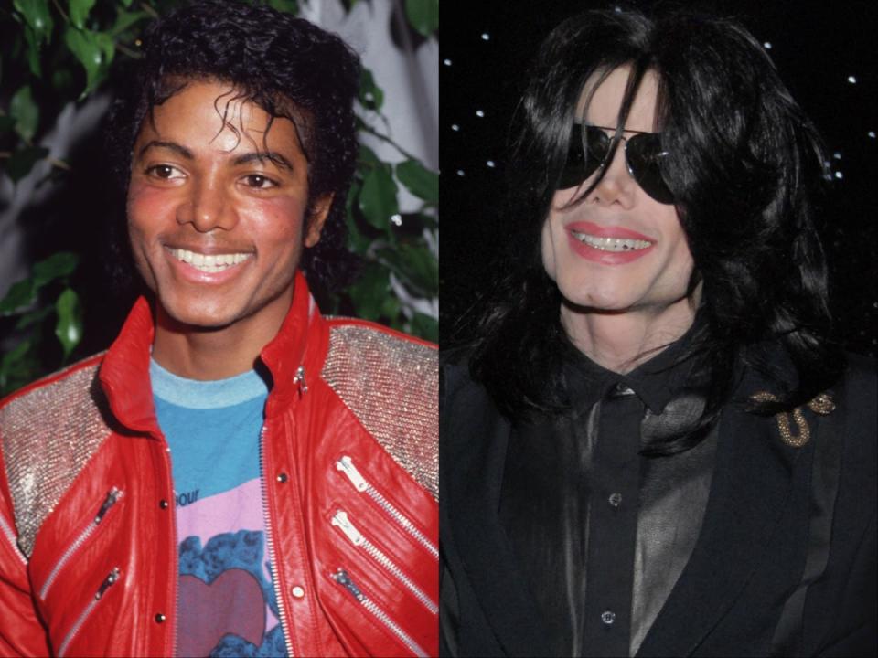 On the left, Michael Jackson in 1983. On the right, Jackson in 2007.