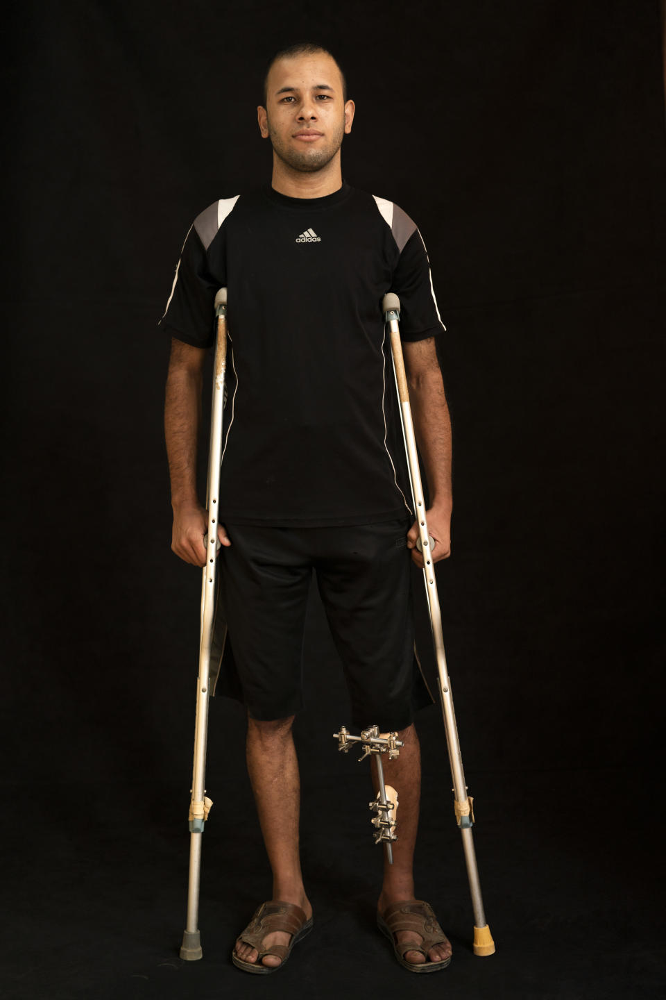 In this Sept. 19, 2018, photo, Mohammed Shabit, 26, poses as he awaits treatment at a clinic run by MSF (Doctors Without Borders) in Gaza City. Shabit says he suffered two fractures of the left leg while marching with demonstrators during a peaceful protest at the border. (AP Photo/Felipe Dana)