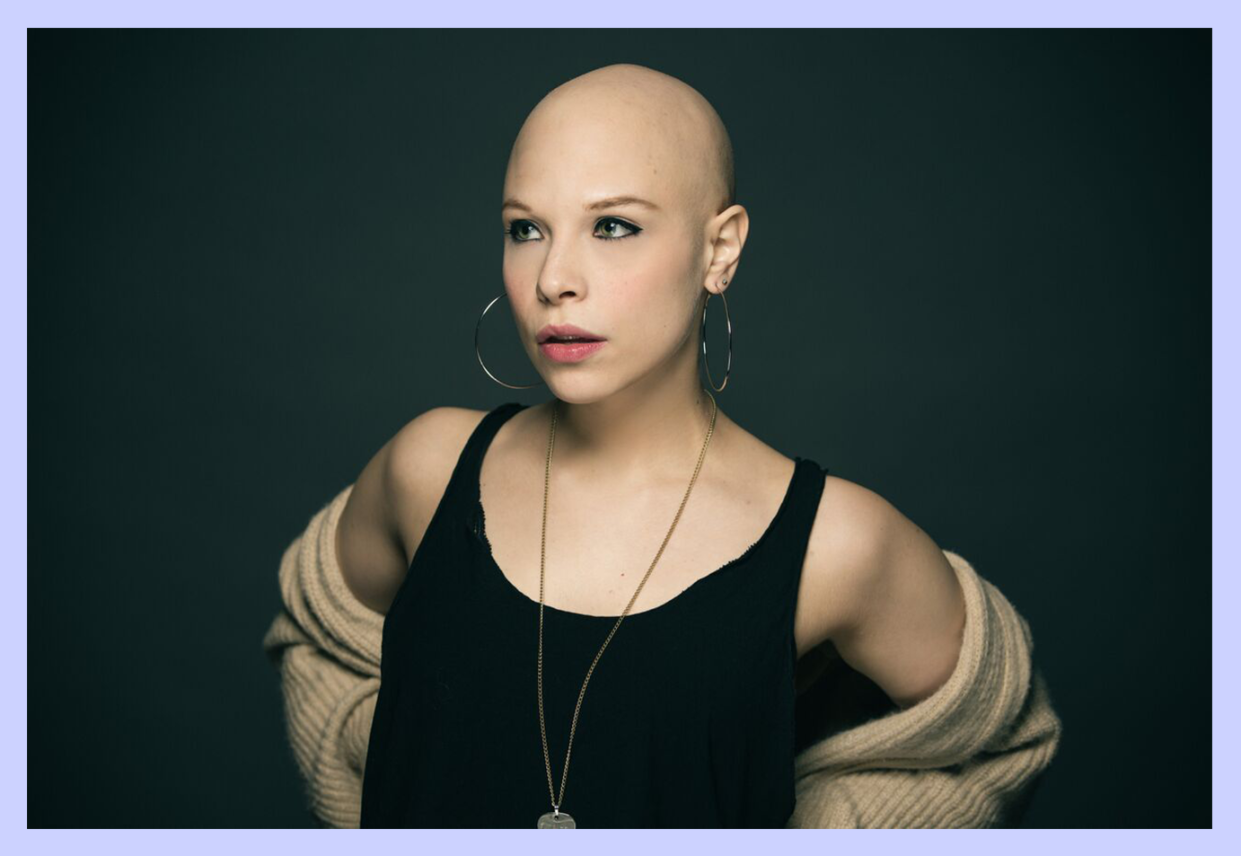 Actress Lauren Marcus after her hair loss. (Photo: Eric Woolsey; artwork by Quinn Lemmers for Yahoo Lifestyle)