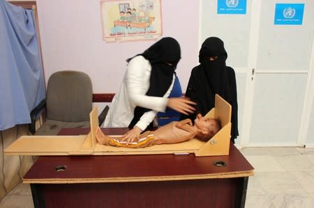 Nurse measures malnourished Muath Ali Muhammad at a health center in Aslam district of the northwestern province of Hajja