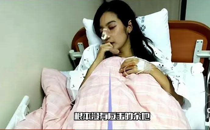 陸網Po照指林志玲被打斷鼻子，但照片中女子是韓星李敏英。（網路圖片）