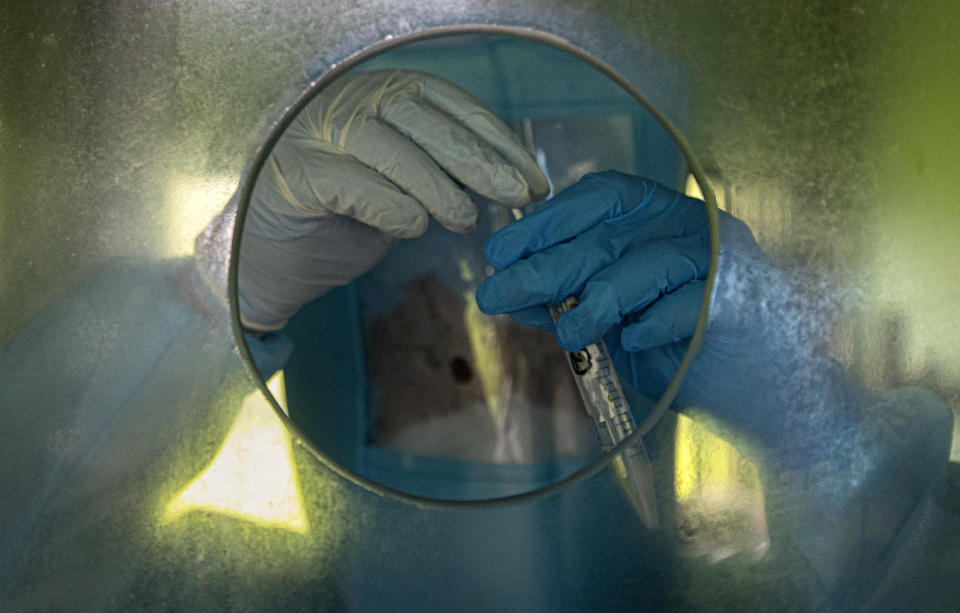 An Indian health worker collects nasal swab samples at a COVID-19 testing center in Gauhati, Assam state, India, Sunday, July 12, 2020. India is the world’s third worst-affected country by the coronavirus. (AP Photo/Anupam Nath)