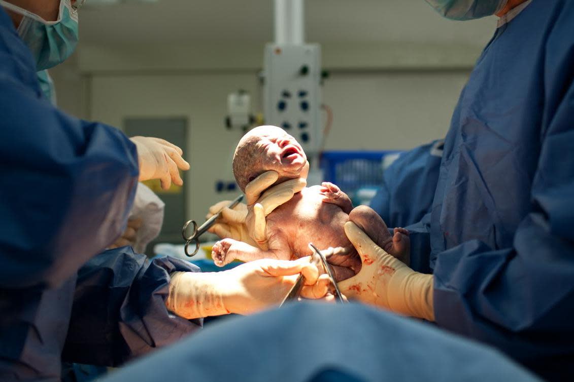 I consider my birth to have been just as natural as anyone else's: Getty/iStockphoto