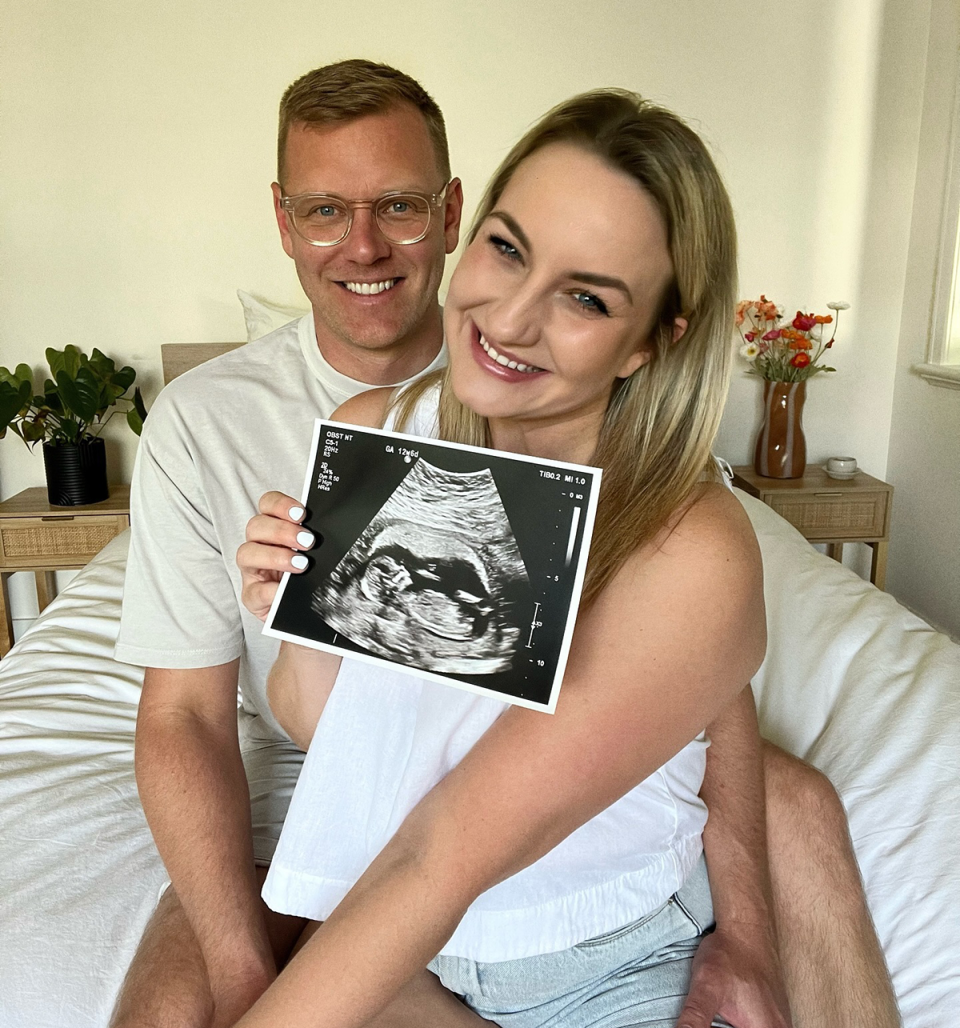 Bachelor in Paradise’s Alisha Aitken-Radburn and Glenn Smith holding an ultrasound image.