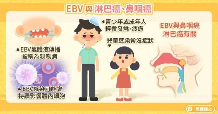 EBV與淋巴癌、鼻咽癌