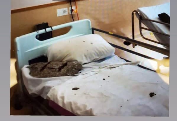 青山醫院病床天花塌石屎　擊中枕頭邊　醫管局隔近四個月無公布
