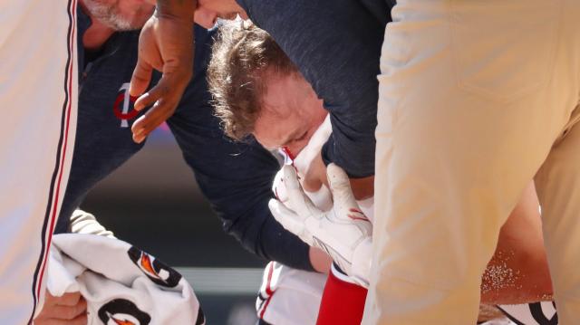 Kyle Farmer INJURED AFTER HIT-BY-PITCH TO FACE!