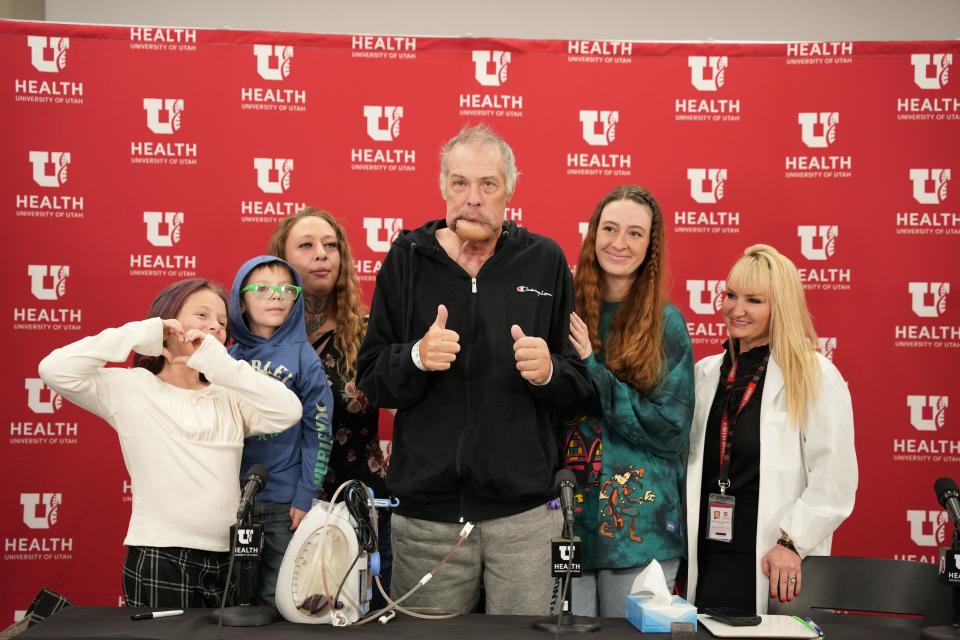 Rudy Noorlander's pictured with his grandchildren, daughters, and Doctor during a press conference at the University of Utah Hospital in Salt Lake City.