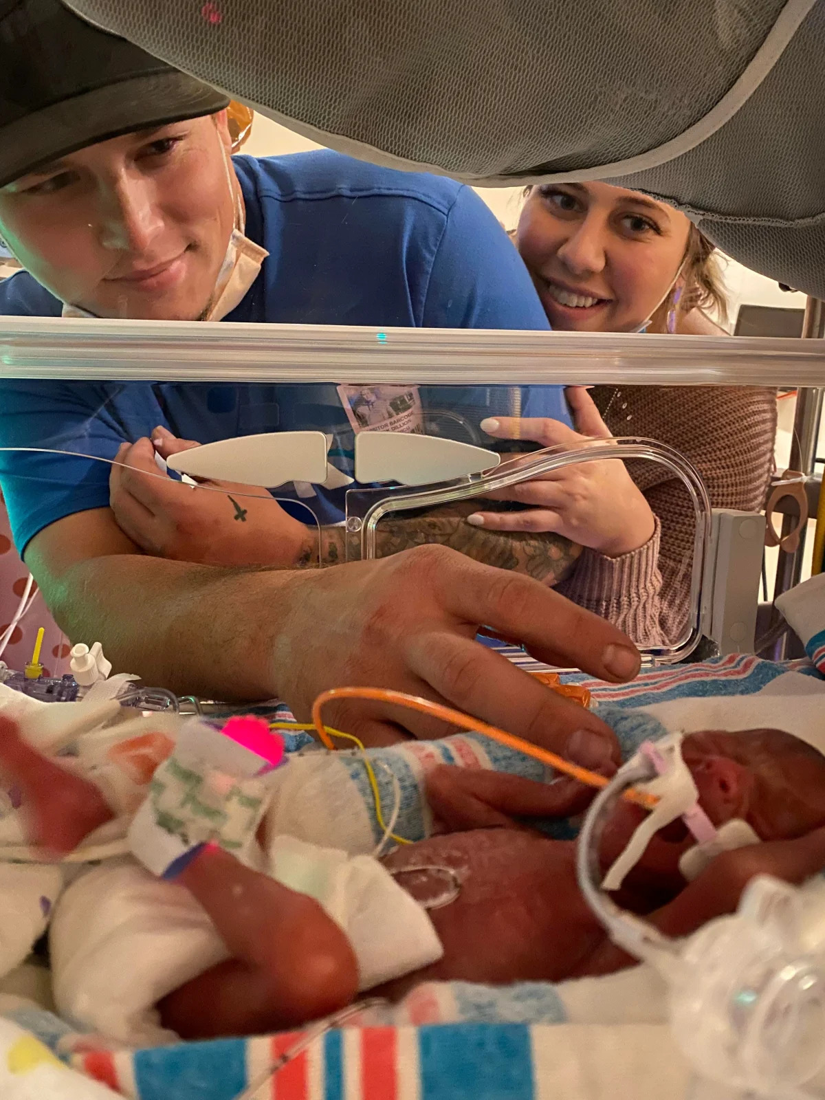 Twin girls born at 22 weeks after mom was 'upside down' for six days finally go ..