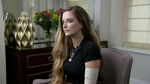 PHOTO: Amber Escudero-Kontostathis, survivor of the Aug. 4 lightning strike near the White House, is interviewed by Good Morning America, in Washington, Aug. 15, 2022. (ABC News)