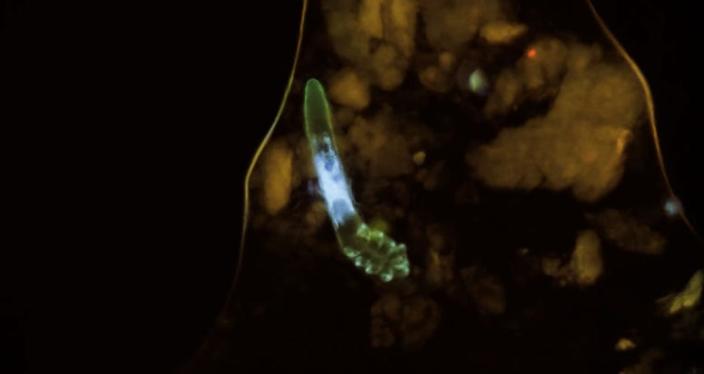 Imagen microscópica de un ácaro facial.